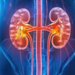 Drug combo improves survival for some kidney cancer patients