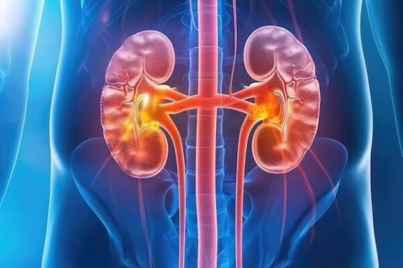 Drug combo improves survival for some kidney cancer patients